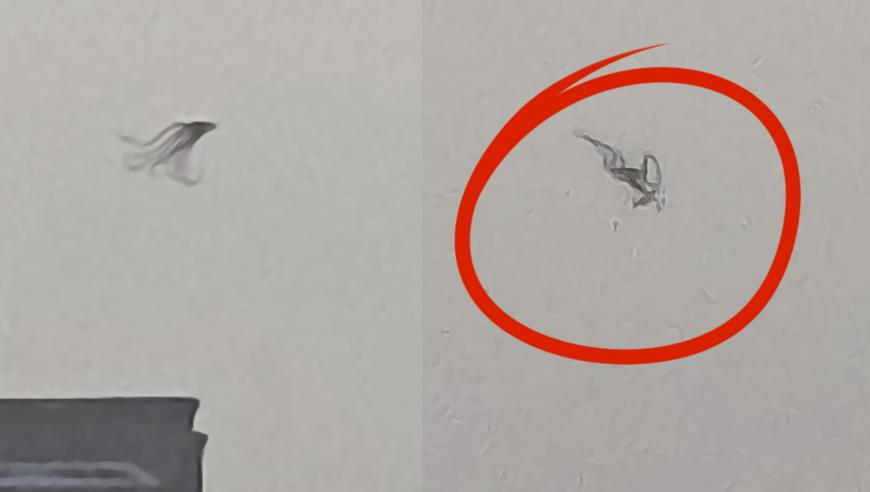 刘伯温四肖八码凤凰艺术,男子饭后肚子剧痛抽出牛奶血,广泛的解释落实支持计划_正式版V11.63